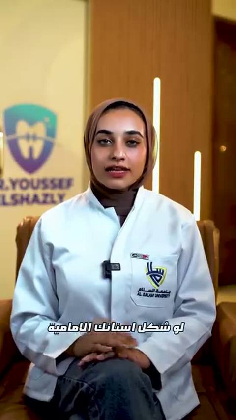 ابتسامة هوليوود بالفينير